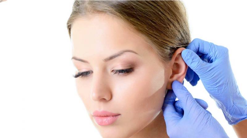 جراحی زیبایی گوش (اتوپلاستی) چیست؟