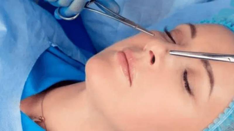 علت و درمان افتادگی نوک بینی بعد از عمل