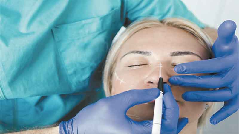 تکنیک های نوین در هنر عمل جراحی زیبایی بینی