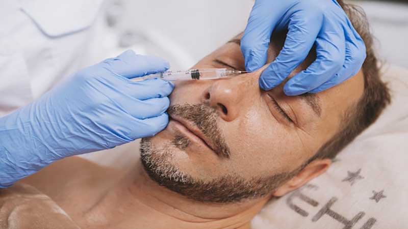 انواع جراحی بینی مردان