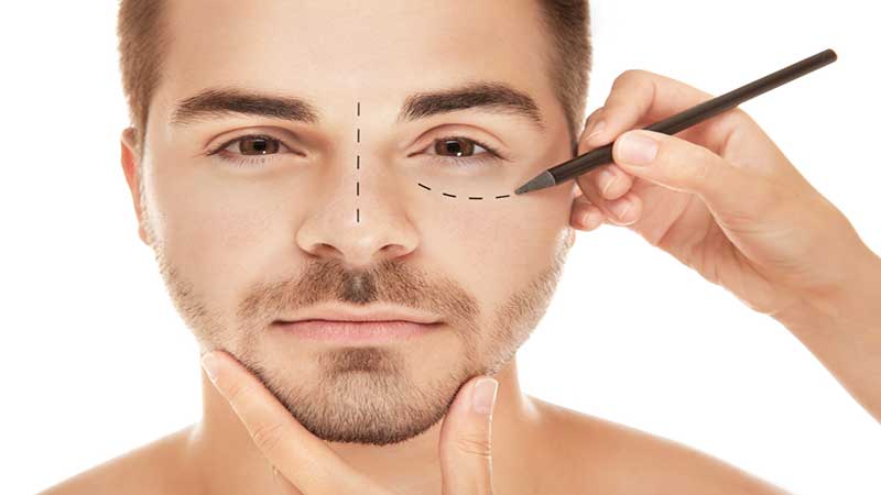 جراحی بینی مردان به صورت باز یا بسته