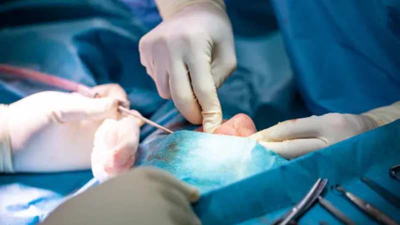 آیا جراحی های همزمان با جراحی بینی را می توان انجام داد؟
